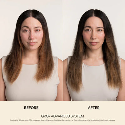 GRO+ Advanced Balancing Conditioner